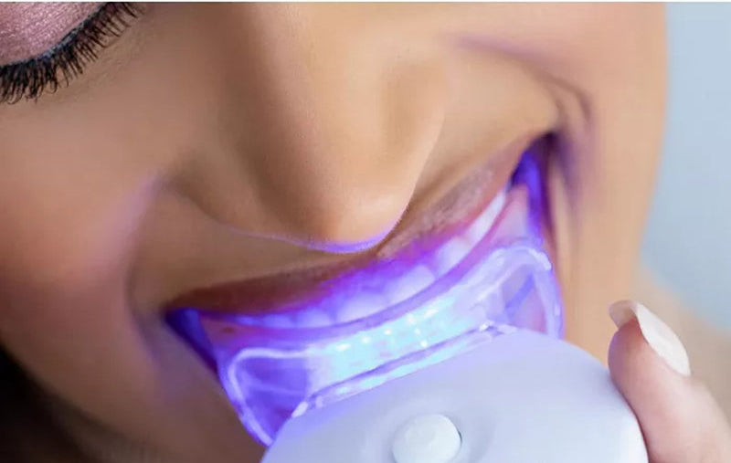 BrightSmile Deluxe Teeth Whitening Kit